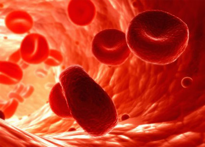 Anemia de Fanconi