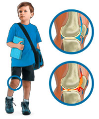 Cuidados en la Artritis crónica juvenil.