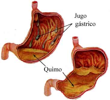 Análisis del jugo gástrico.