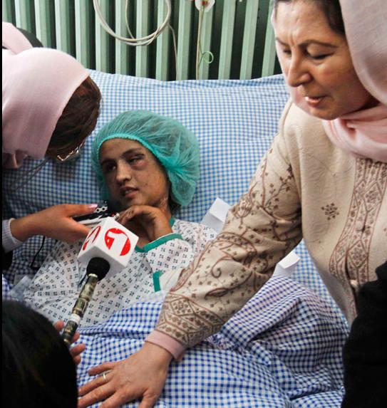 Joven afgana torturada recibirá atención médica en la India