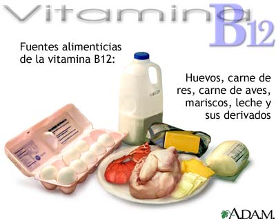 Anemia por deficiencia de vitamina B12.