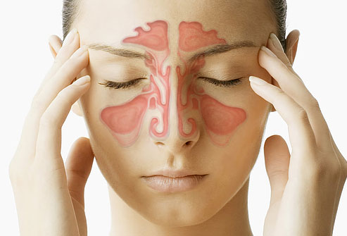 ¿Cómo tratar la sinusitis?