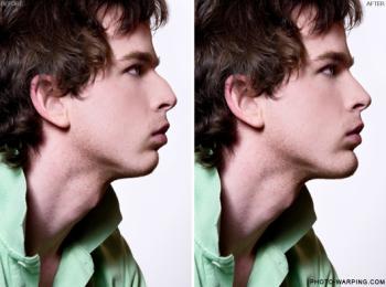 Virtual plastic surgery