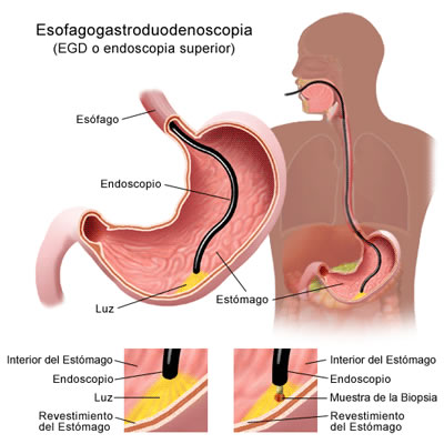 Principales causas y características de las hemorragias digestivas.