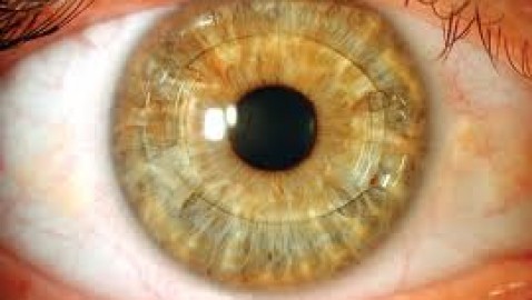 Lente fáquico para mejorar la visión.