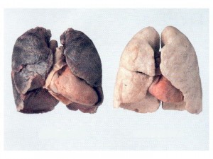 Los beneficios de dejar de fumar se notan muy pronto.