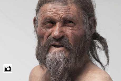 El ¨hombre del hielo¨ tenía los ojos marrones, era delgado y padecía del corazón.