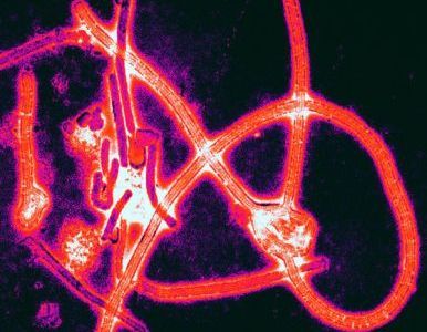 Crean una potente vacuna contra el virus ébola.