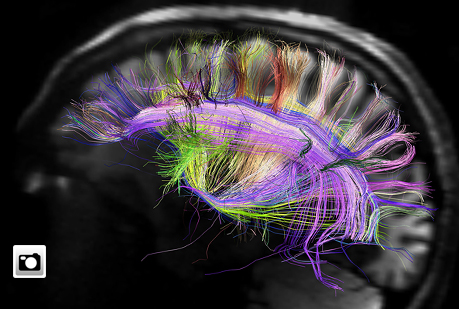 El cerebro al desnudo.