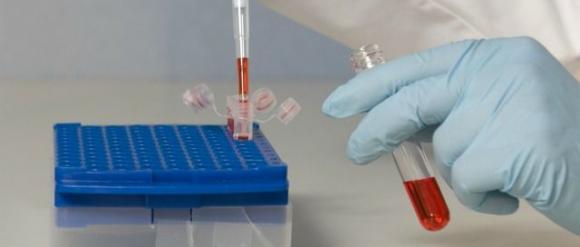 Cientificos Argentinos comprueban que el azúcar inhibe la producción de toxinas en gangrena gaseosa , proyectan el desarrollo de un antibiótico