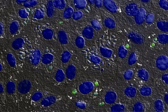 Cientificos Argentinos identifican un posible blanco contra el parásito de la enfermedad de Chagas