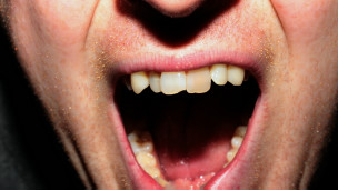 ¿Por qué gritamos ¡ay! cuando nos golpeamos?