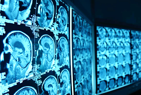 Un escáner de tu cerebro permite predecir cuánto engordarás y cuánto sexo practicarás