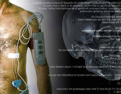 Pinchazos en el corazón por control remoto.