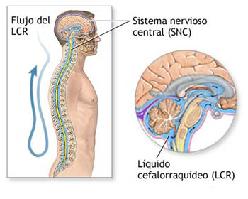 El fluido espinal podría contener claves para determinar el síndrome de fatiga crónica.