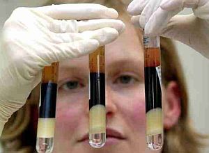 El 80% de quienes padecen Inmunodeficiencias Primarias lo ignoran