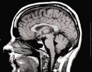 Identifican genes vitales en la actividad cerebral.