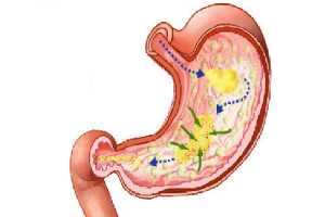 Semillas de Lino y Limón para la Salud Digestiva.