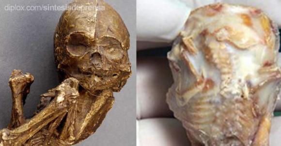 Anciana pare un bebé fósil 56 años después