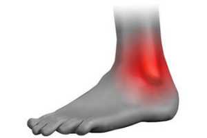 Jugo de Aloe como Tratamiento para los Esguinces.