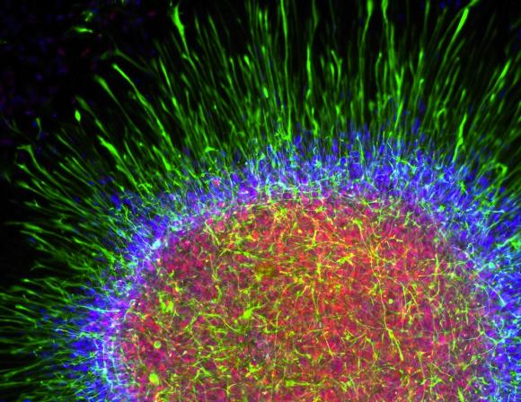 El cerebro se parece a todas las cosas del universo: el arte de las neuroimágenes (FOTOS)