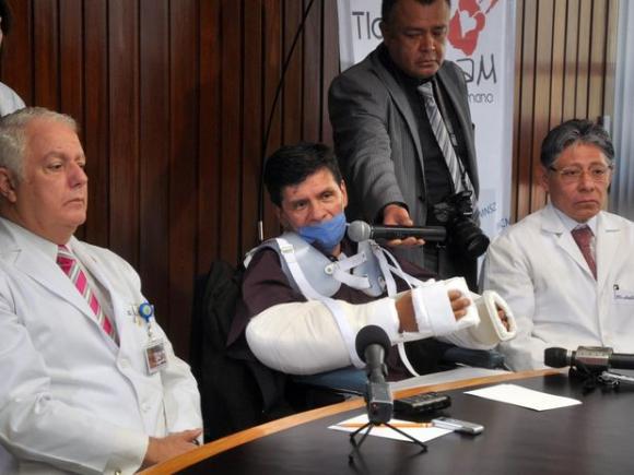 Trasplante de brazos, México logra primer caso exitoso