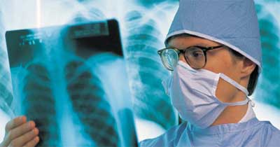 Estudio revela expansión de tuberculosis resistente a fármacos