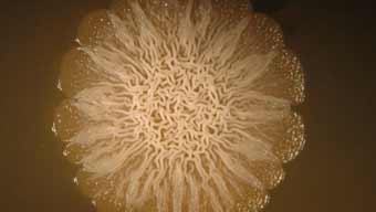 Investigadores Argentinos logran combatir a la bacteria más peligrosa para los diabéticos