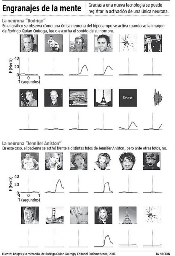 Crean en Argentina un Centro Avanzado de Registros Intracerebrales en el Hospital Ramos Mejía