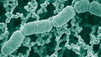 Investigadoras Argentinas encuentran más propiedades benéficas en las bacterias lácticas , entre ellas evitarían las infecciones urinarias