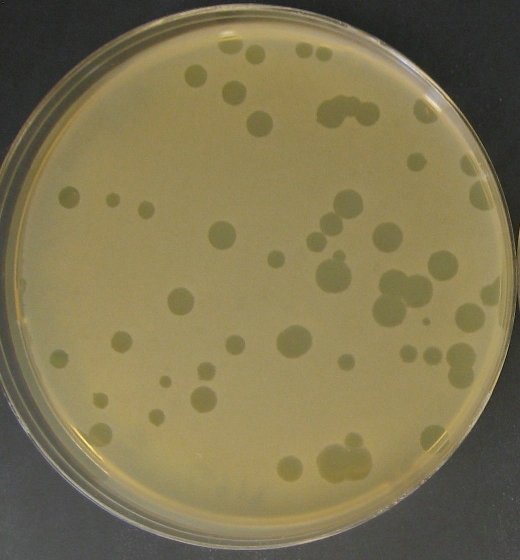 Médicos proponen usar cepas de virus para combatir bacterias del acné