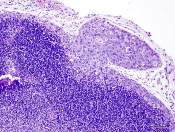 Investigadores Argentinos crean un modelo que permite estudiar el cáncer de mama más agresivo