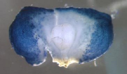 Descubren molécula que sirve para el diagnóstico de tumores en la hipófisis