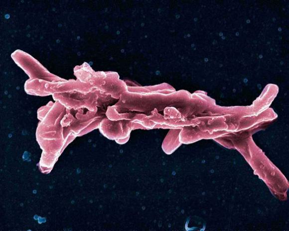 Grupo de científicos de Argentina y de EE.UU. desarrollaron un test de diagnóstico de la bacteria causante de la tuberculosis