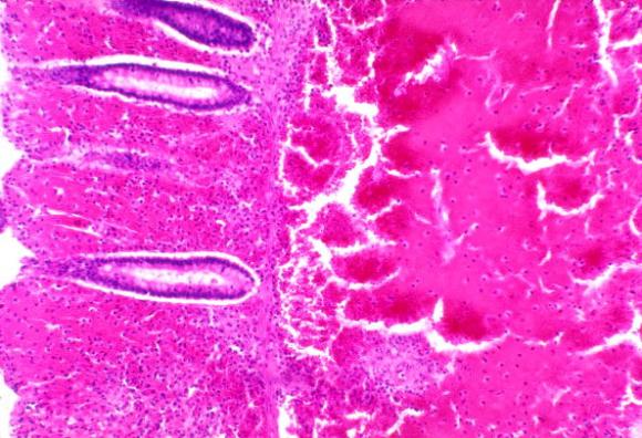 La clave del intestino para alejar virus y bacterias está en sus propios nutrientes