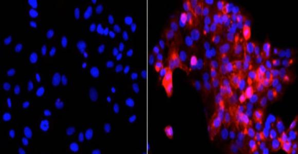 Un peligroso virus similar al SARS afecta a humanos y a animales