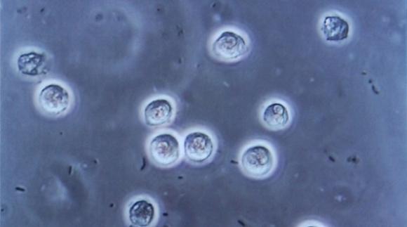 Médico Argentino inventó un nuevo tipo de sonda urinaria que baja el riesgo de infección