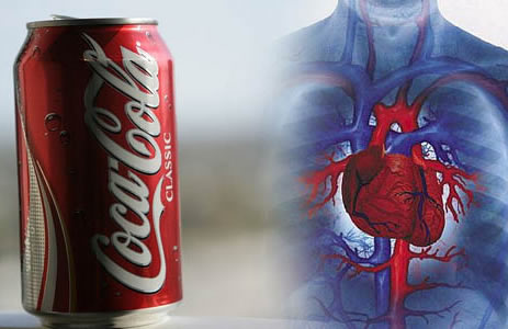 Vicios que matan: Una mujer de 30 años murió por consumo excesivo de Coca-Cola