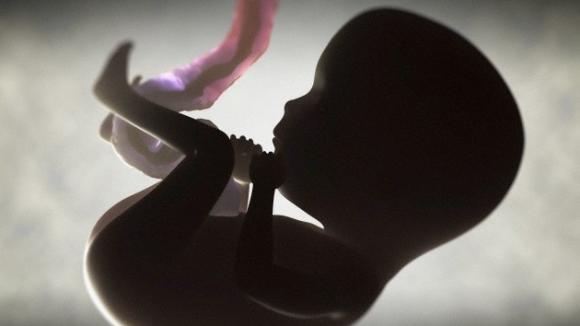 Salvan a un feto con anemia al practicarle una transfusión a través del cordón umbilical