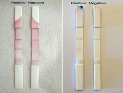 Investigadores Argentinos desarrollan un diagnóstico rápido del Síndrome Urémico Hemolítico‏
