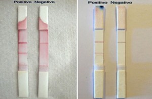 Investigadores Argentinos crean un método de diagnóstico rápido del Síndrome Urémico Hemolítico