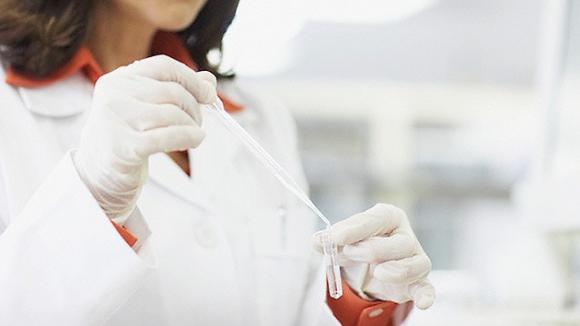 Descubren las raíces moleculares del síndrome de Down