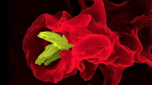 ¨Tuberculosis incurable¨, amenaza ¨real¨ del colapso sanitario global