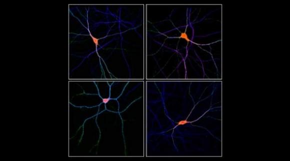 Científicos Argentinos descubren dos proteínas fundamentales para entender la bipolaridad