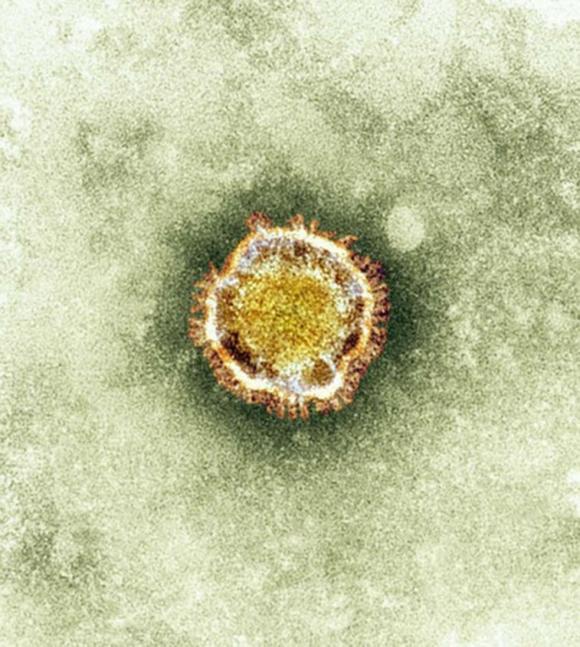 Nuevos tratamientos del coronavirus apuntan en evitar sus efectos en las células pulmonares