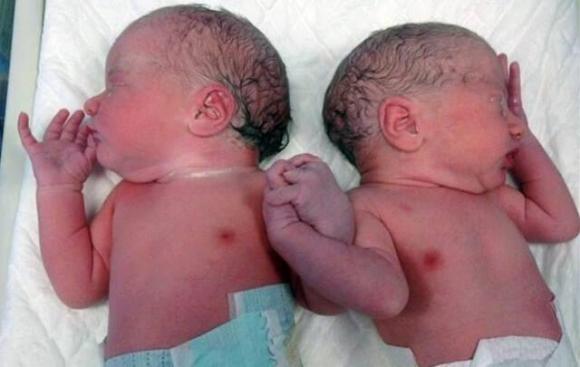 Mellizos recién nacidos se toman de la mano nos interpelan 