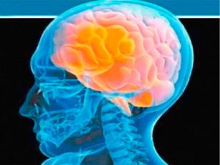 Medicos Argentinos demostraron la vinculacion entre el ataque cerebral nocturno con la fibrilación cardíaca