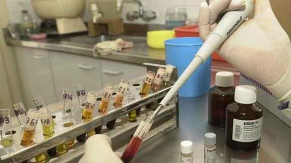 Investigadores Argentinos obtienen indicadores tempranos de complicaciones en diabetes