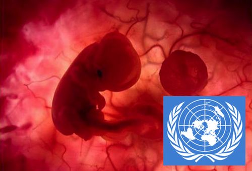 La ONU reconoce que el aborto no es un derecho humano