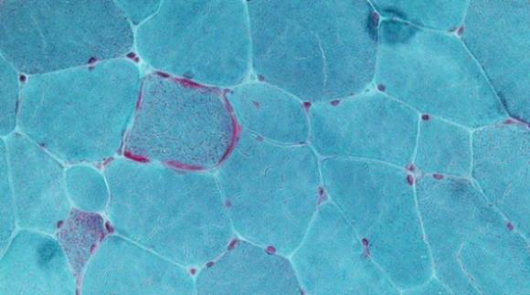 Medicos Argentinos desarrollan una nueva técnica para detectar enfermedades mitocondriales